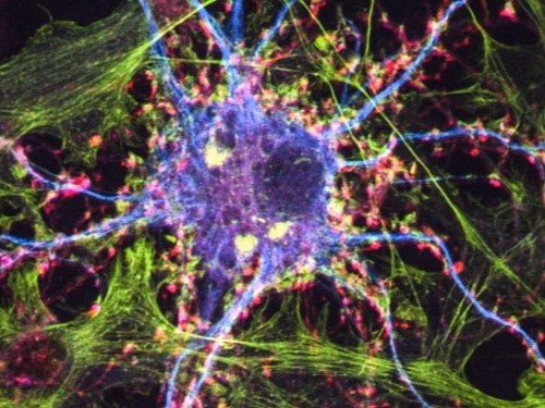 Colored image of nerve cells. 